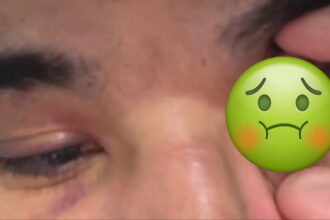 Ozzy Diaz Rushed Into Emergency Laser Eye Surgery Following UFC 313 Victory