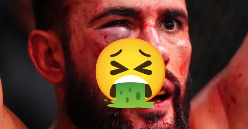 Dana White Shows Off UFC Fighter's Horrifying Lip Injury