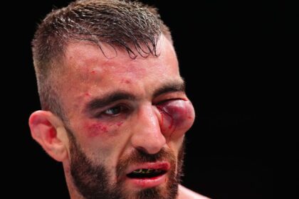 Dana White shares gruesome injury photo of Mohammad Yahya from UFC Abu Dhabi