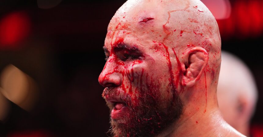 Noche UFC medical suspensions: Jean Silva gets 45 days, two fighters receive indefinite sits