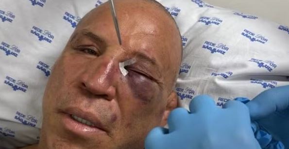 Wanderlei Silva’s post-fight attacker identified as opponent’s son, fighters react to wild knockout