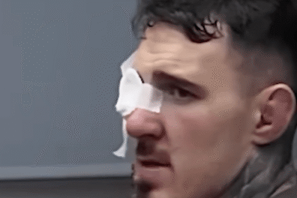 ‘All that training for that’: Watch Tom Aspinall’s backstage reaction to UFC 321 eye poke incident